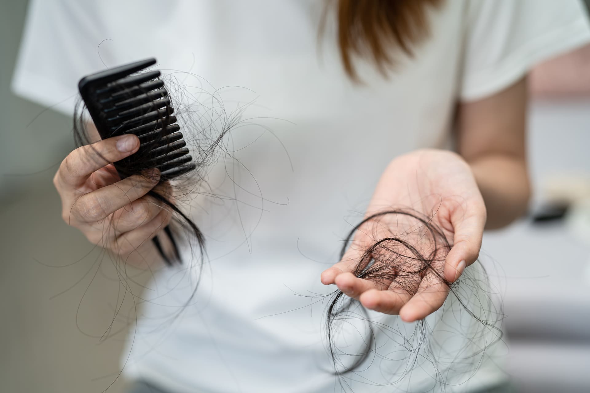 ¿Cómo prevenir la caída del cabello en mujeres? Causas y soluciones