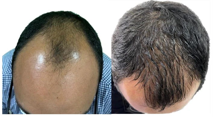 Eduardo S., 42 años