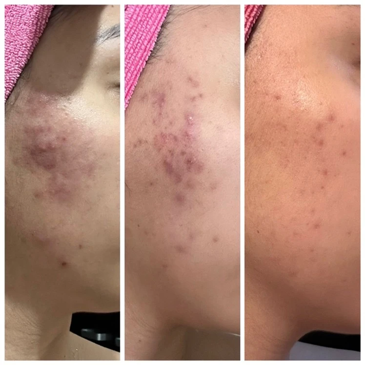 Rocio G., 23 años
